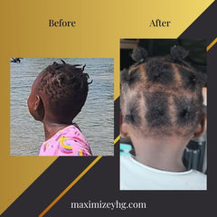 Ultimate Hair Growth Bundle