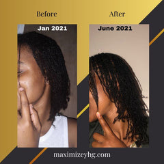 Ultimate Hair Growth Bundle