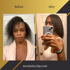 Ultimate Hair Growth Bundle