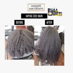 Ultimate Hair Growth Bundle