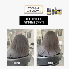Ultimate Hair Growth Bundle